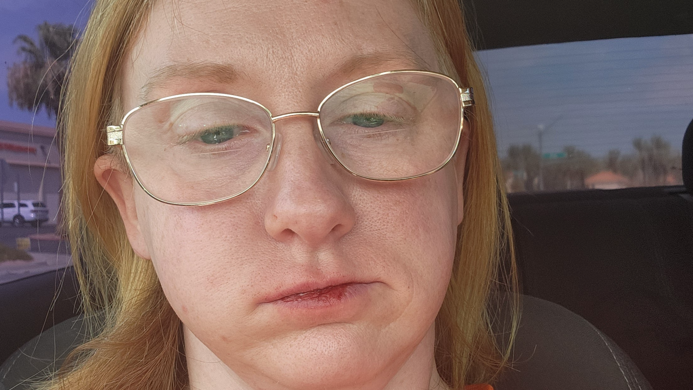 Help Kat smile and eat normally again