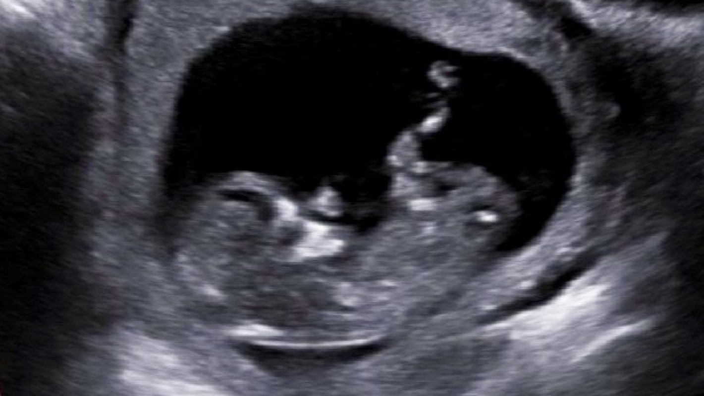 Hope and recovery for unborn child