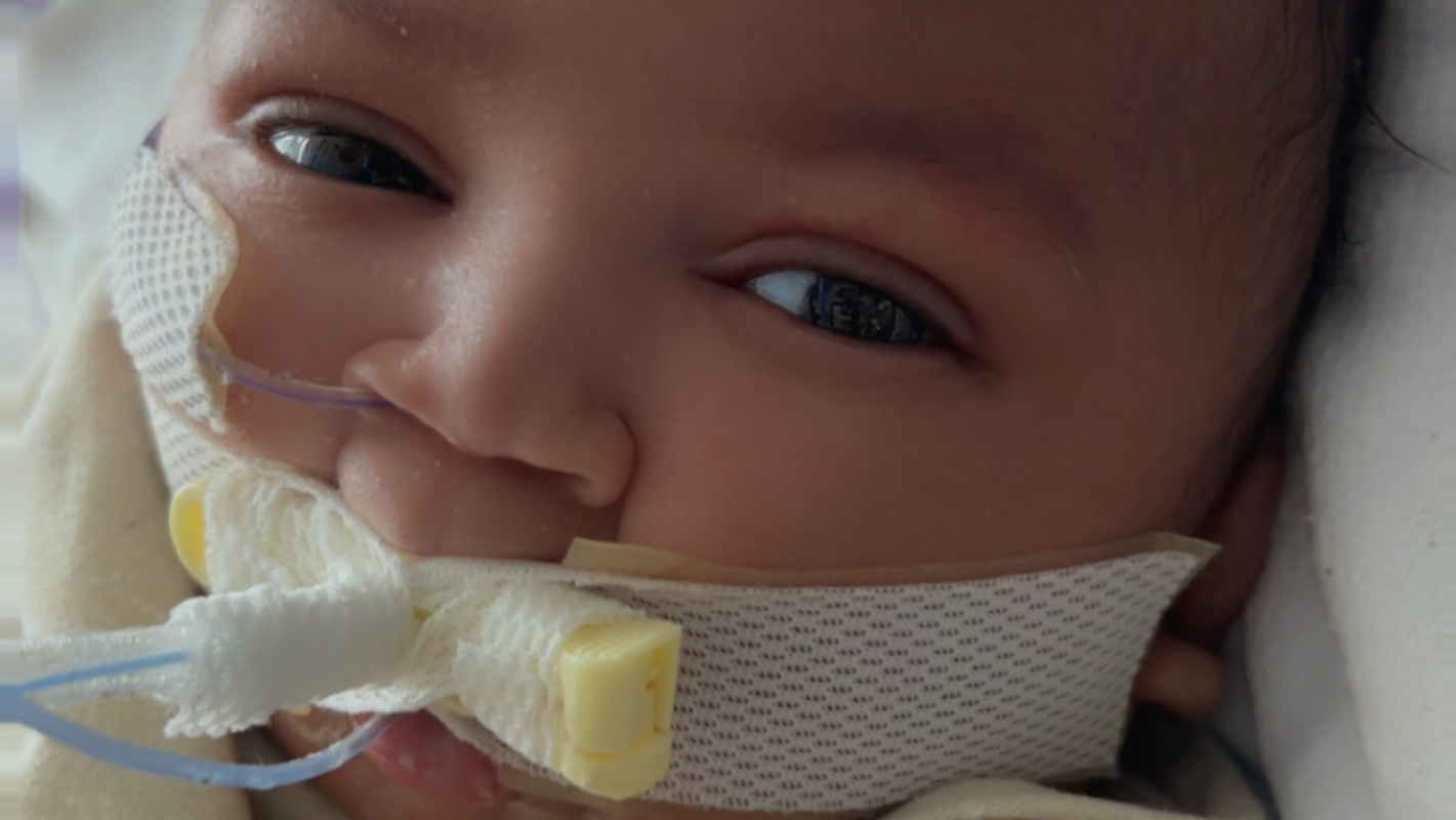 Koa's recovery journey