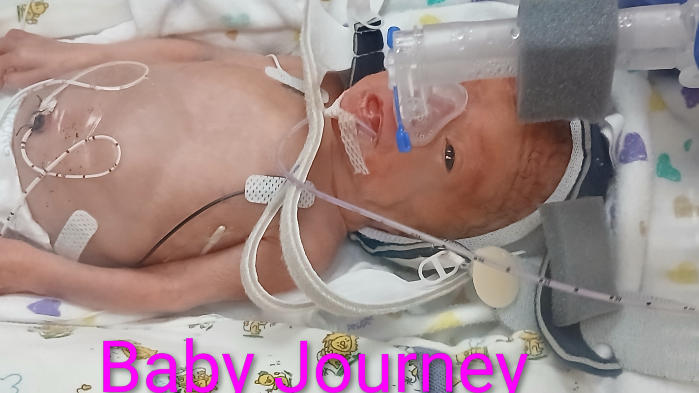 Journey's nicu journey