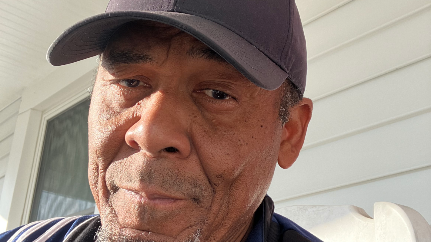 Medical surgery hip replacement for retired vet