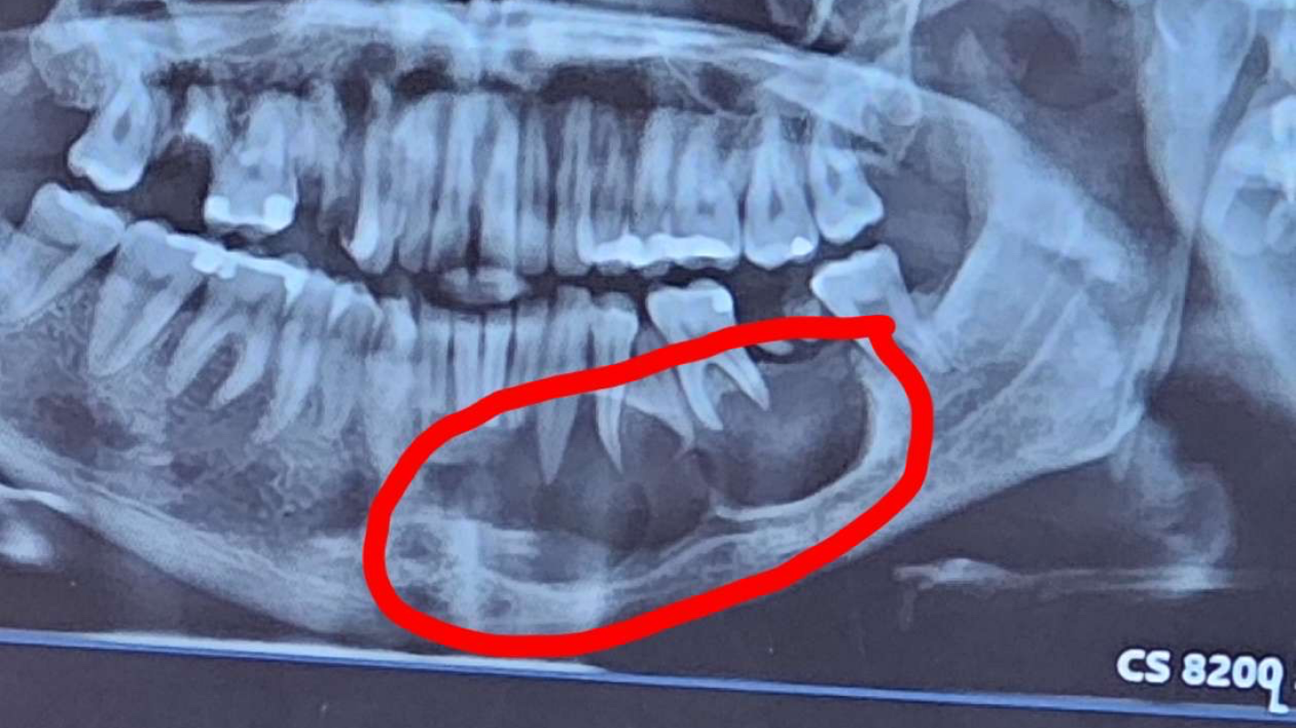 Dental Funds