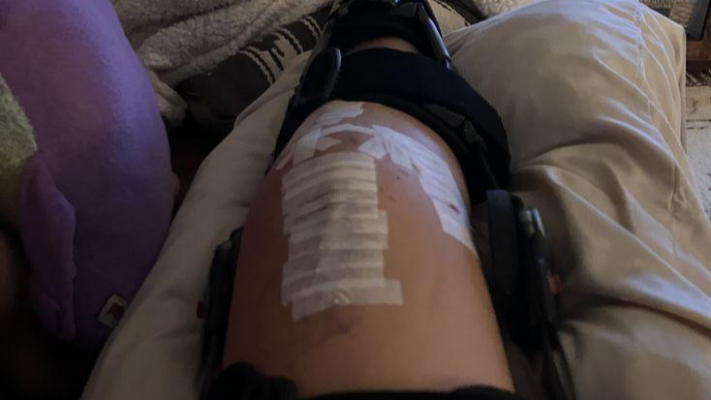 Reclaiming My Mobility And Life After A Severe Fall