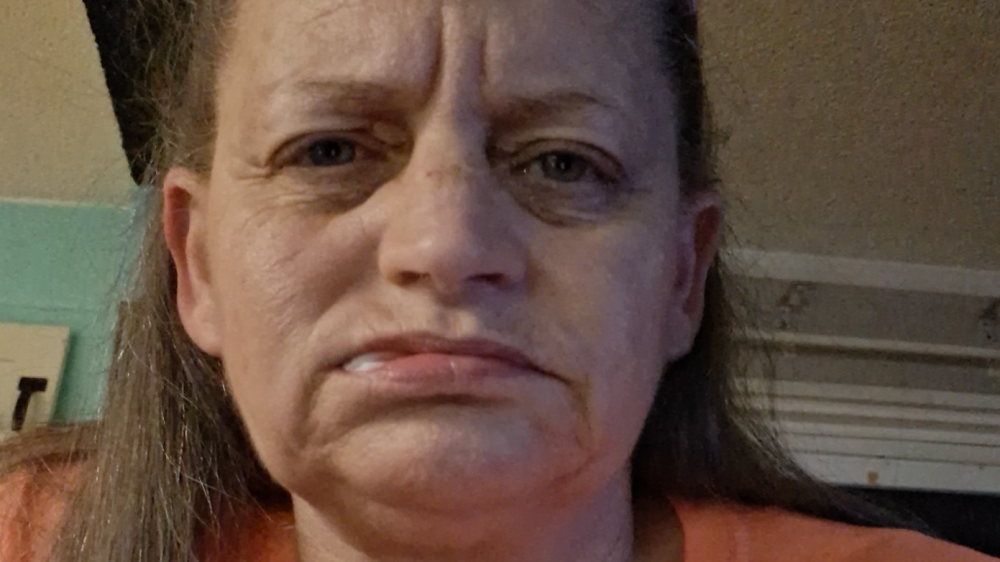 Please help me get my teeth!