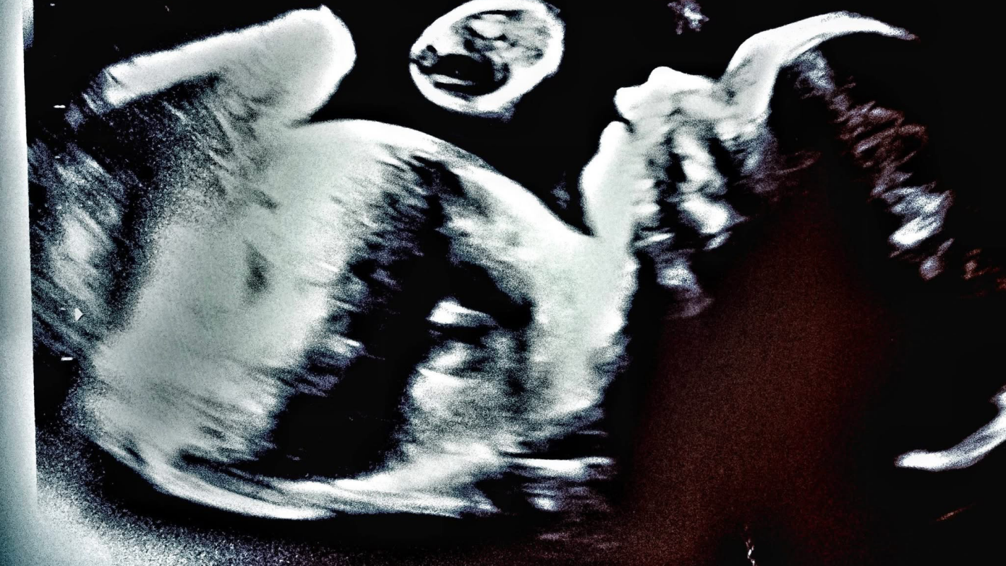 Baby Joey medical expenses