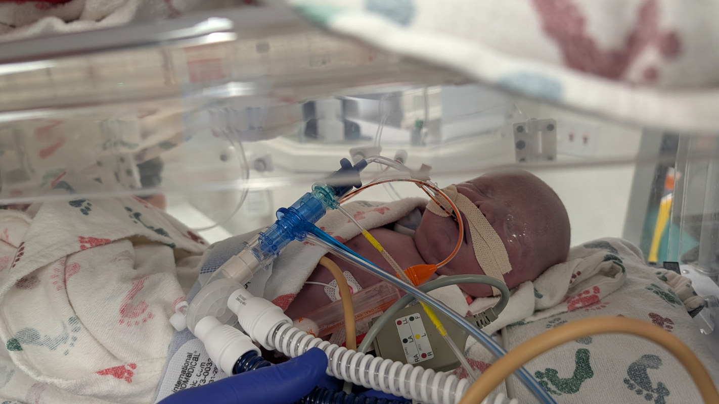 Help Support Baby Alder and the Alder Family