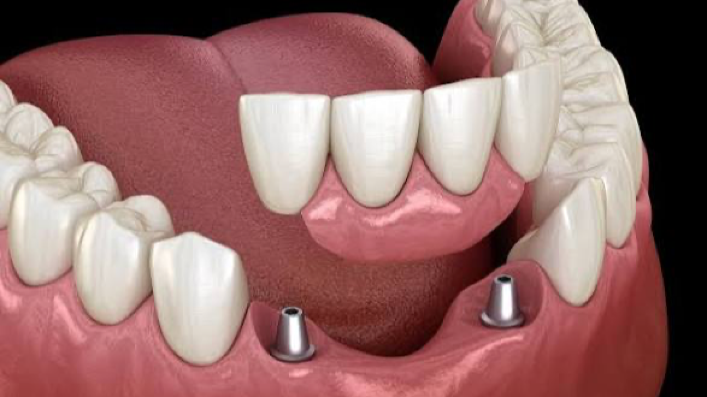 Please help fix my smile