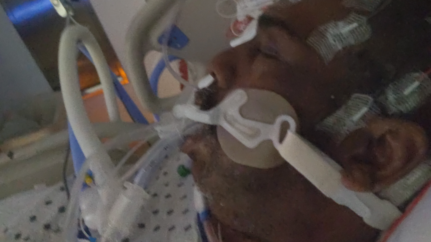 Stroke recovery