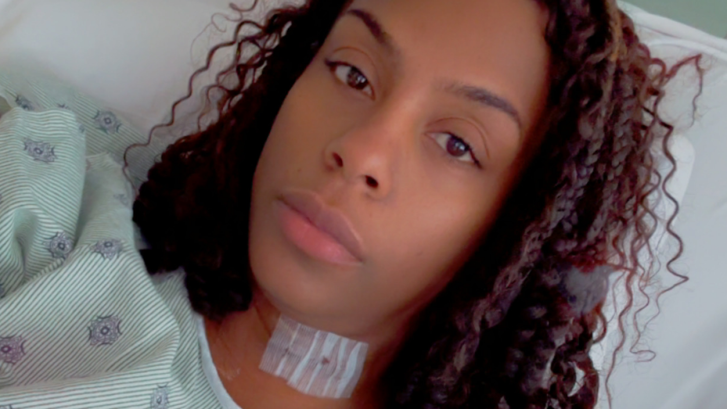 Spine surgery recovery