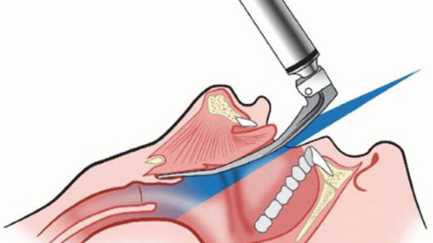 Help fo dental surgery