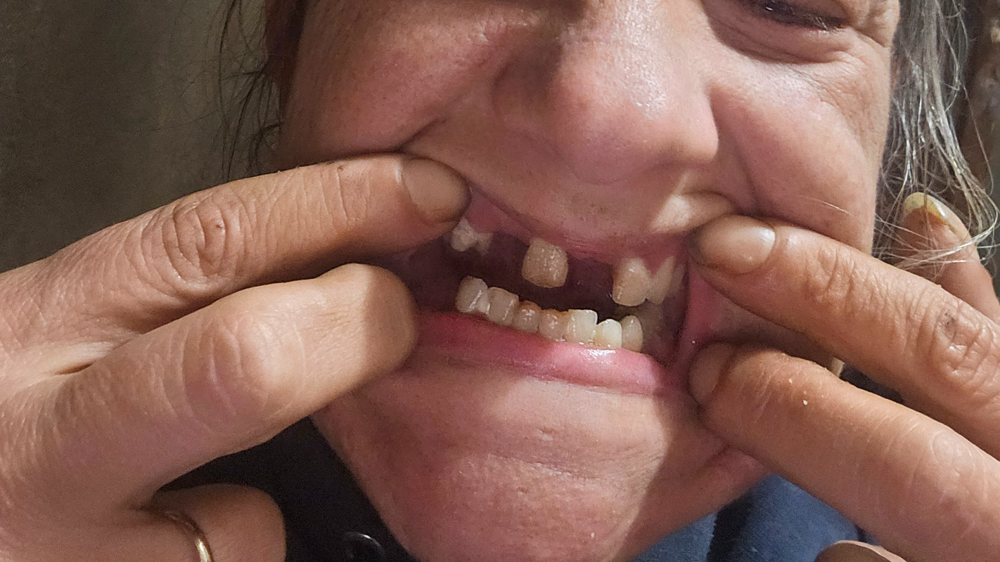 Help Brittany smile again