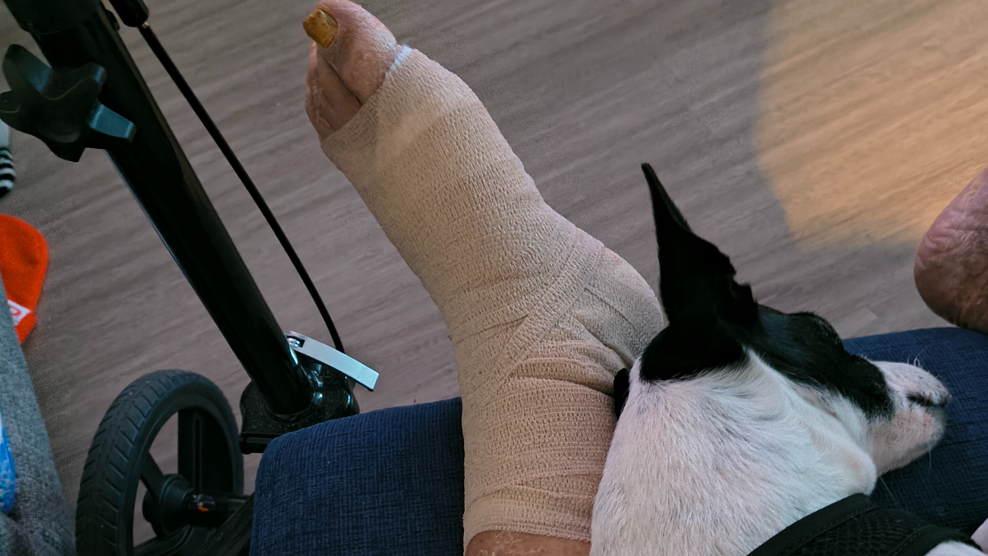 Help Darryl stay on His Feet After Work Injury