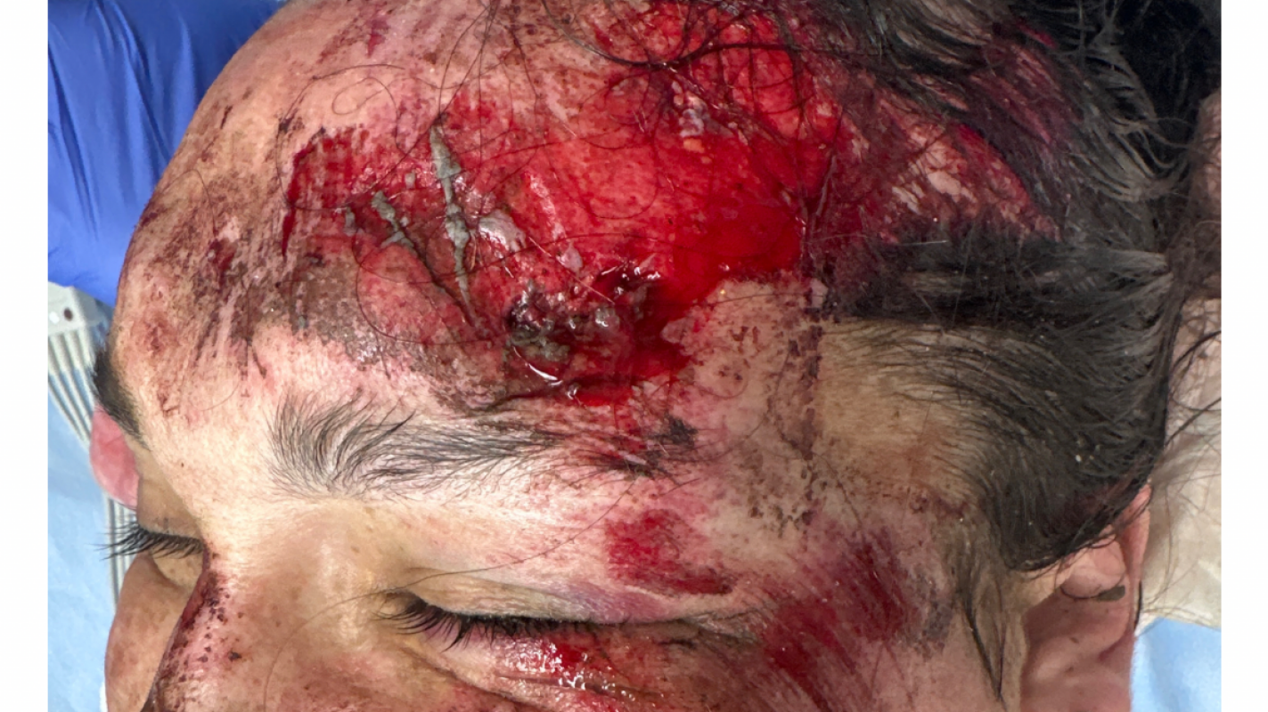 Devastating E-Bike Accident