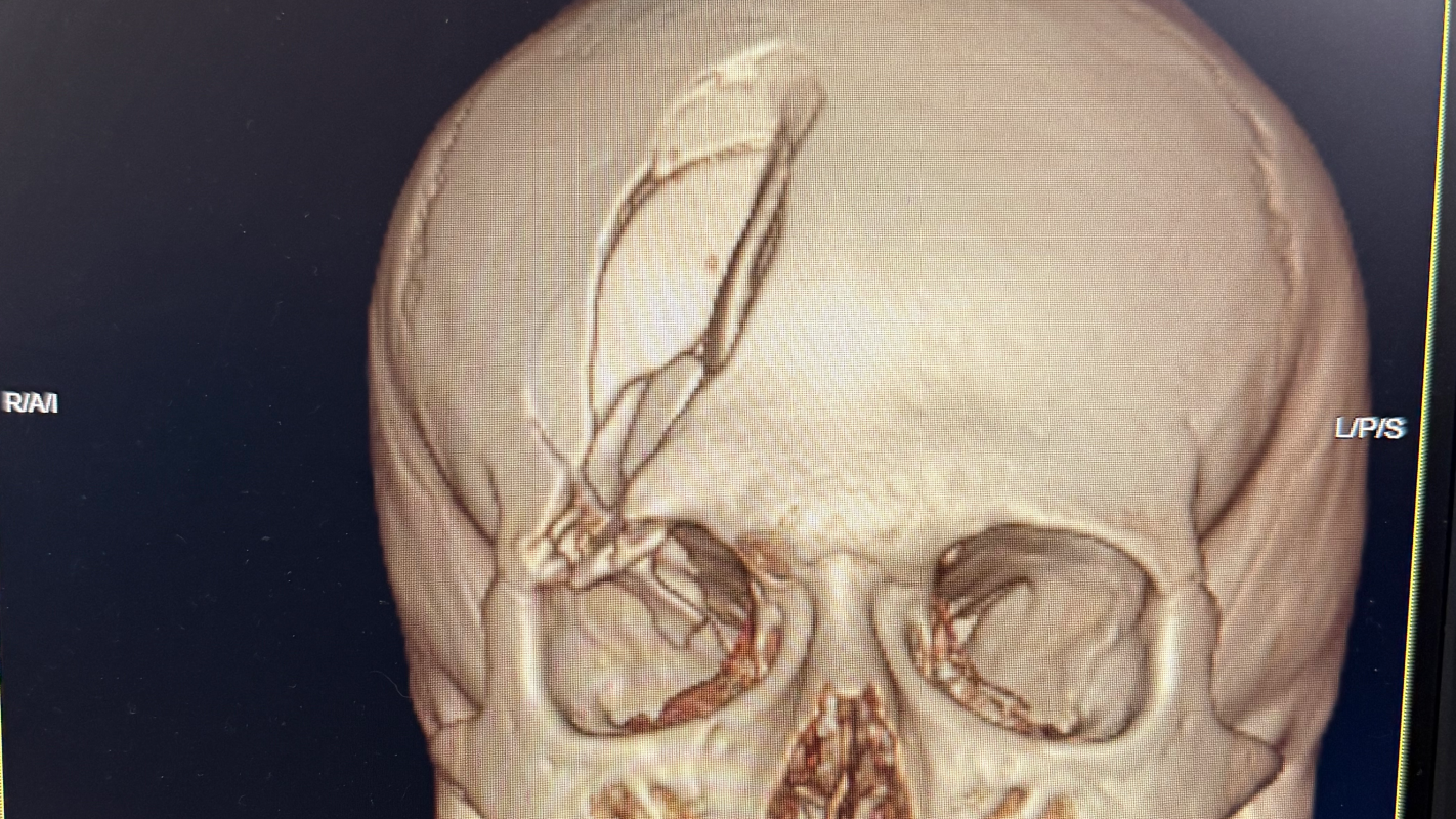 Kayleb Cox Fundraiser