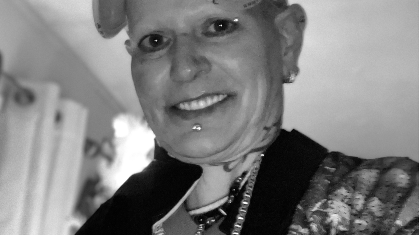 Give A Hand VA postop