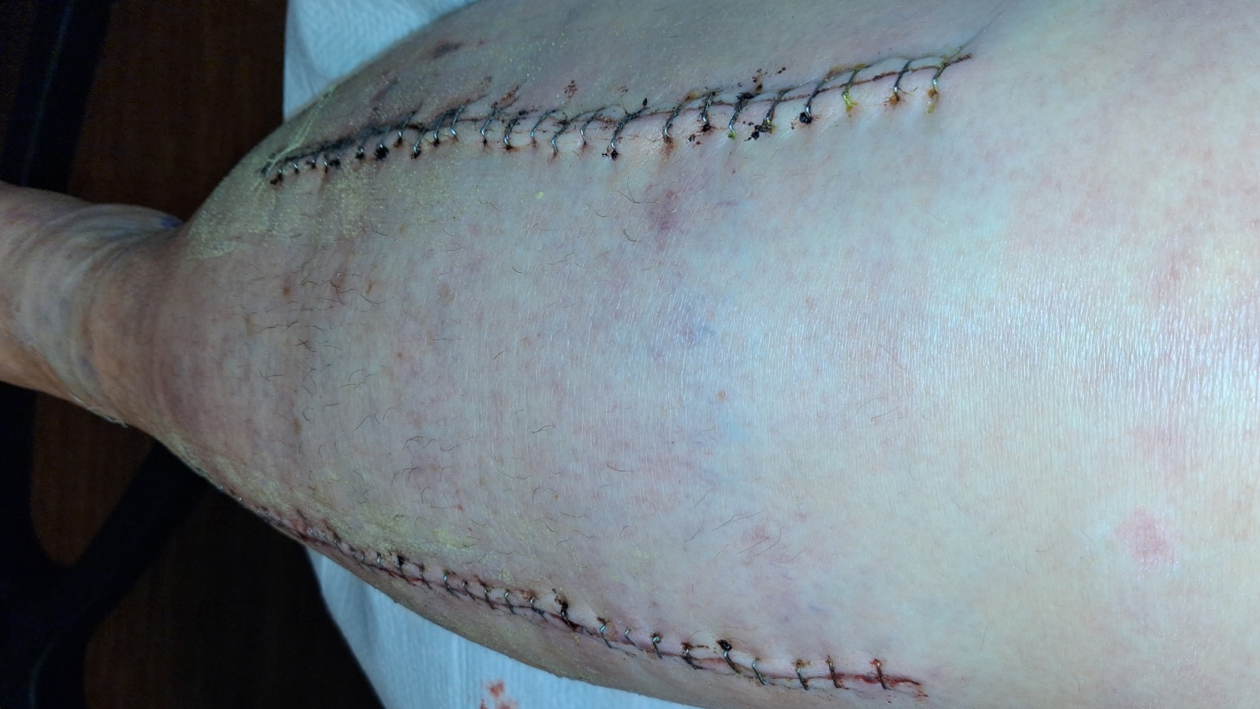 Medical expenses and bills