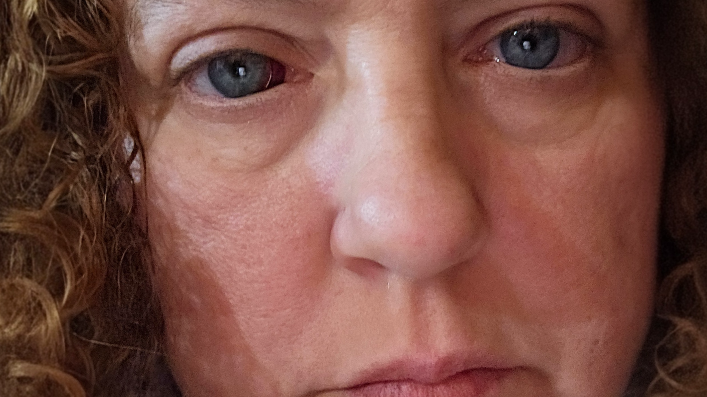 Help with expenses while going through medical treatments.