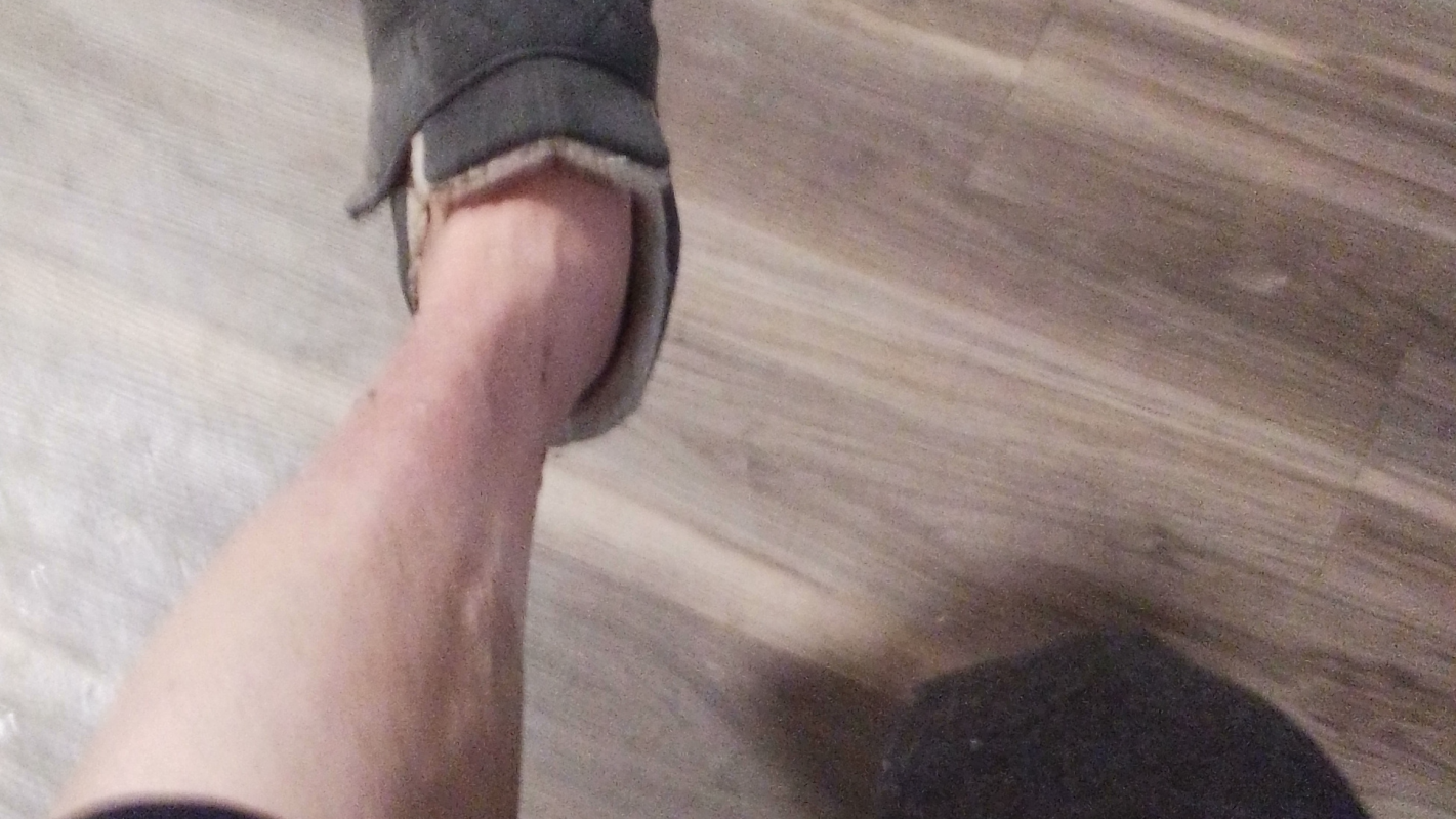 Prostetic leg