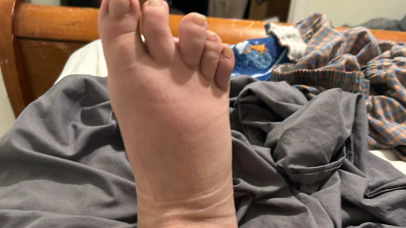 Let me Walk Again - Fall injuries