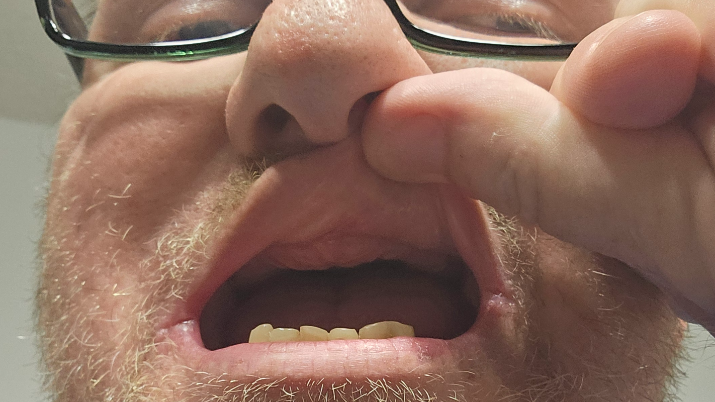 Help a Disabled Navy Veteran Smile and Eat Without Pain