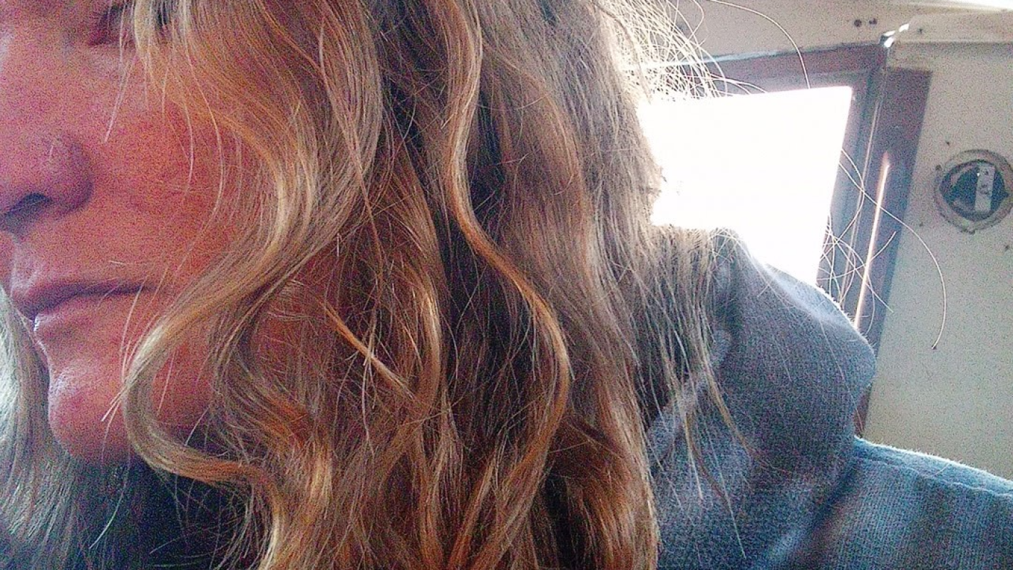 Funding Ann's Journey to a Healthy Smile