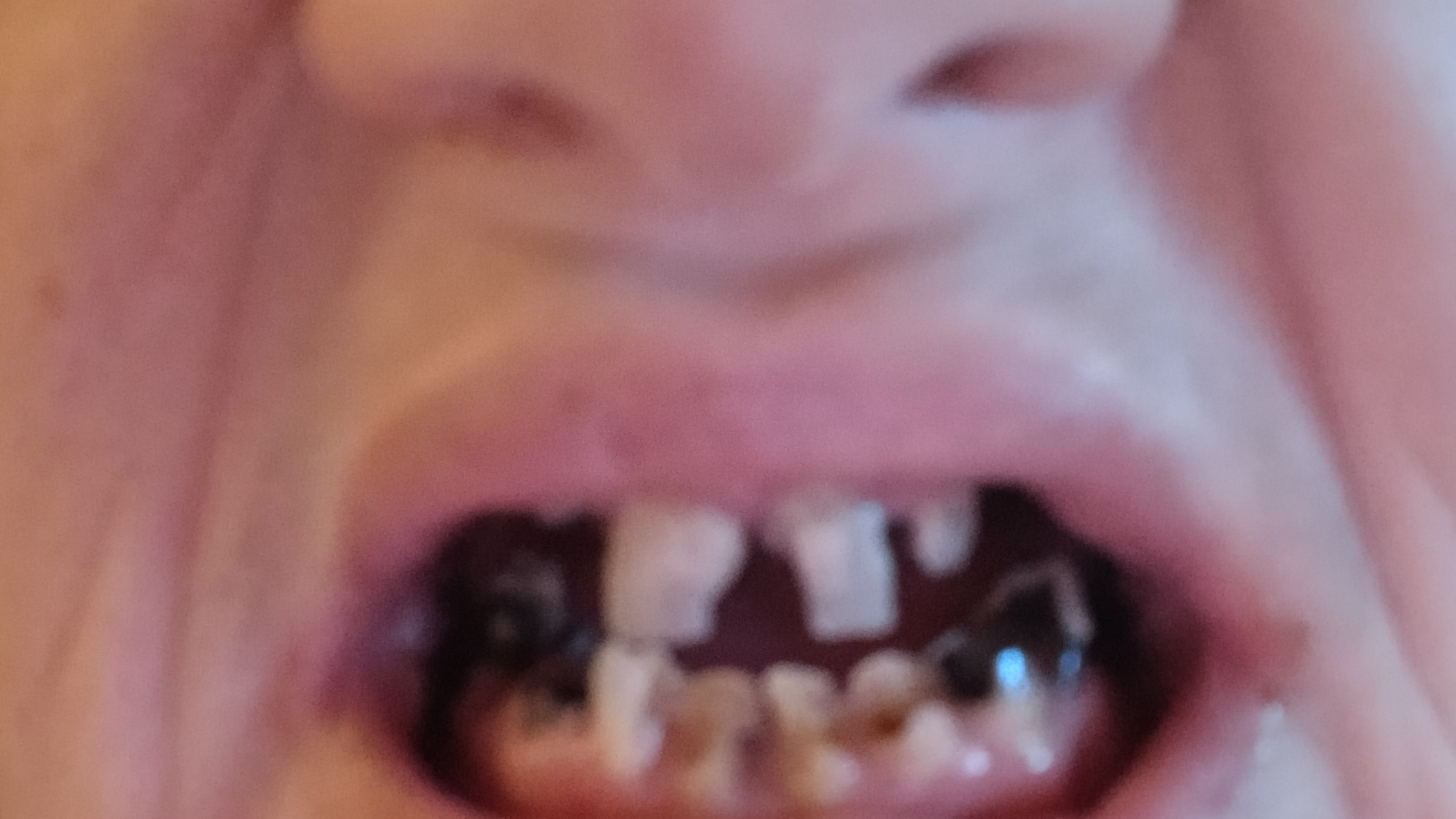 Help with Serious Dental Needs