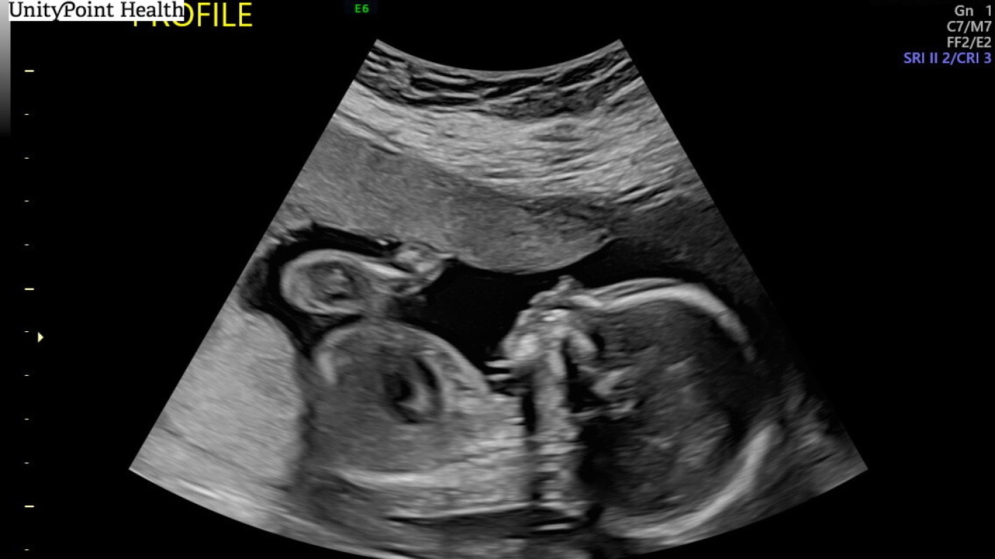 To help me stay close to my newborn in NICU