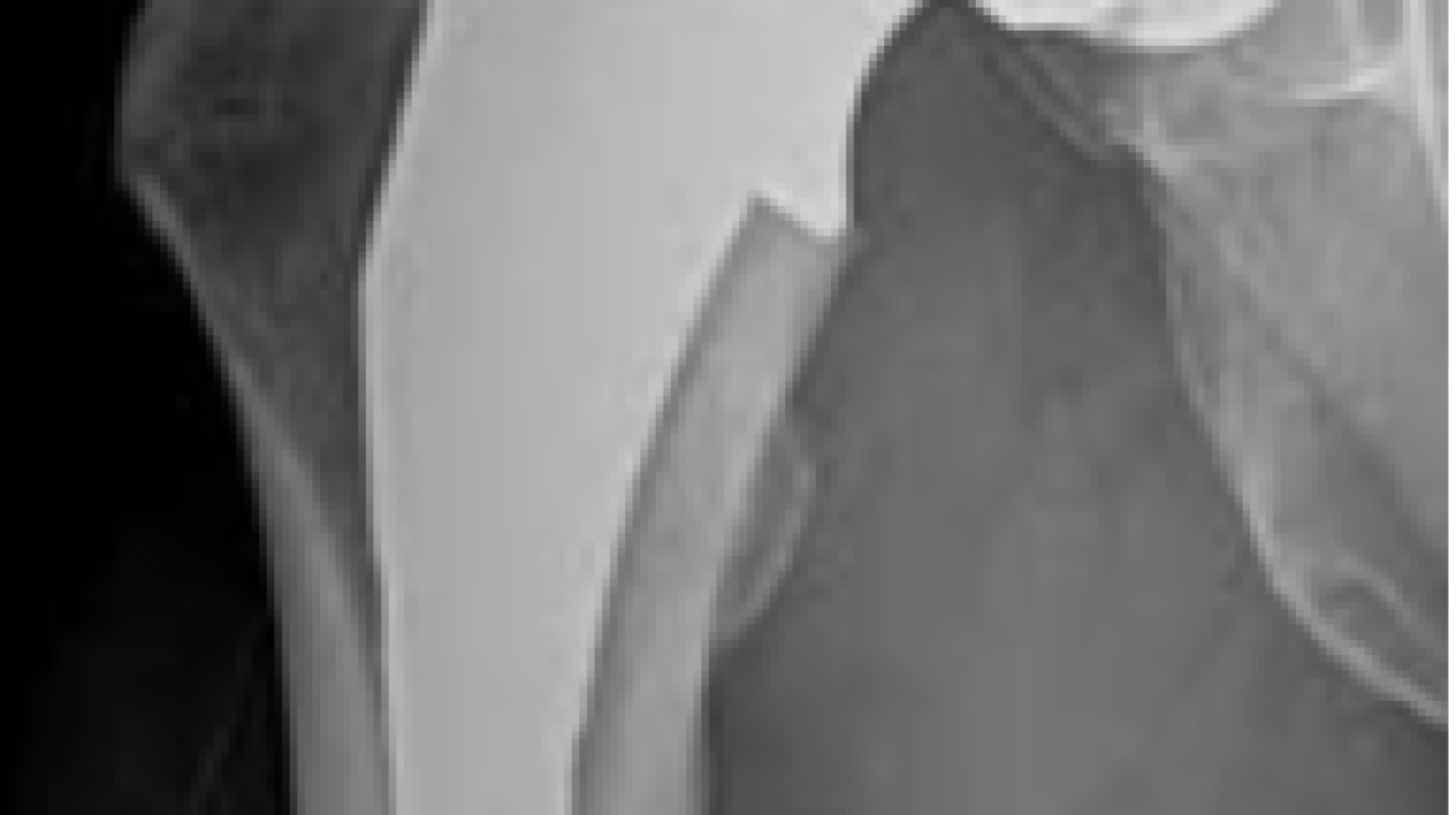 Medical expenses/surgery