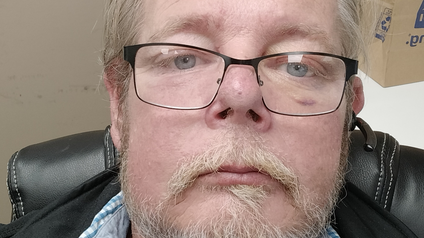 Emergency motel expense