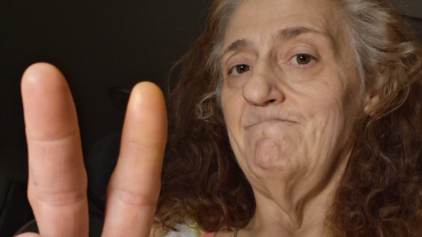 Double amputee needs help