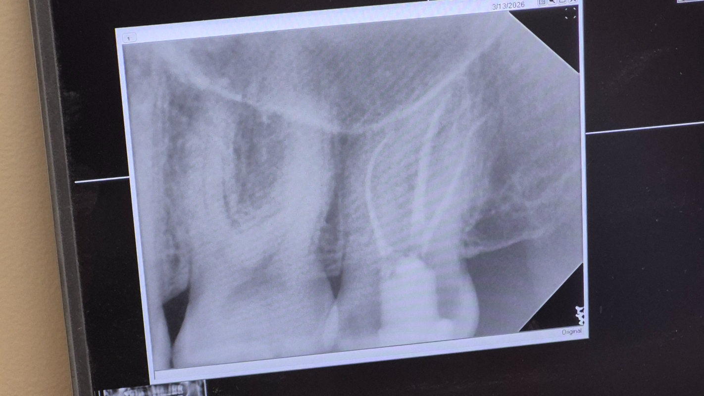 Help me with a dental emergency