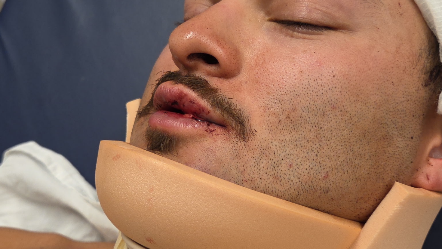 Christian‘s recovery after violent attack