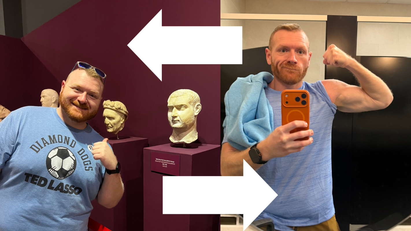 Skin Removal Reconstruction