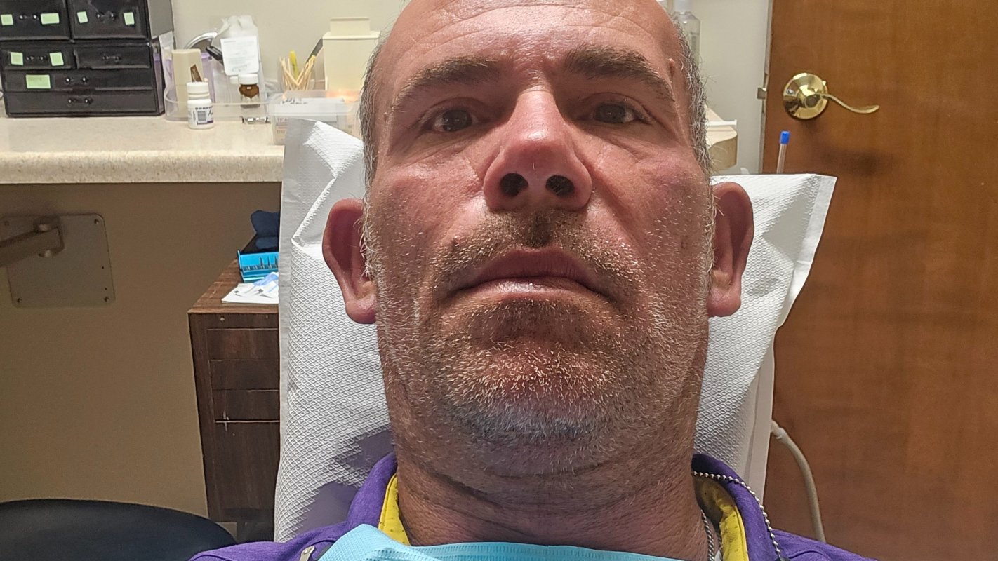Dental surgery and implants