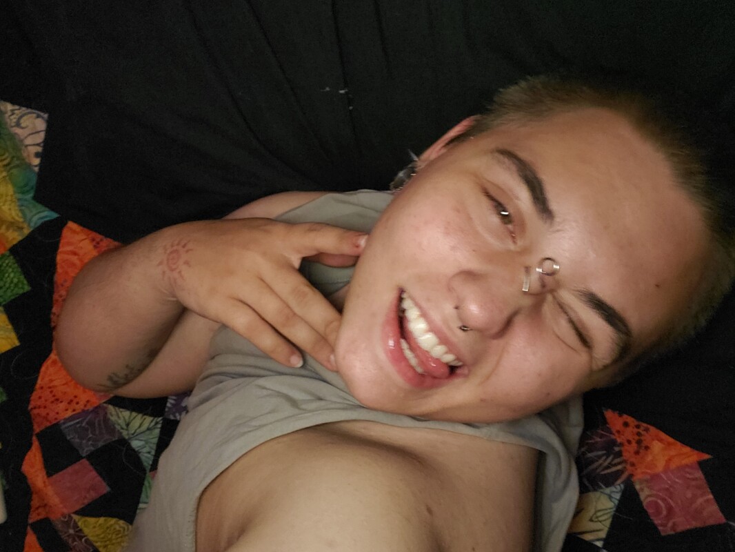 Top Surgery
