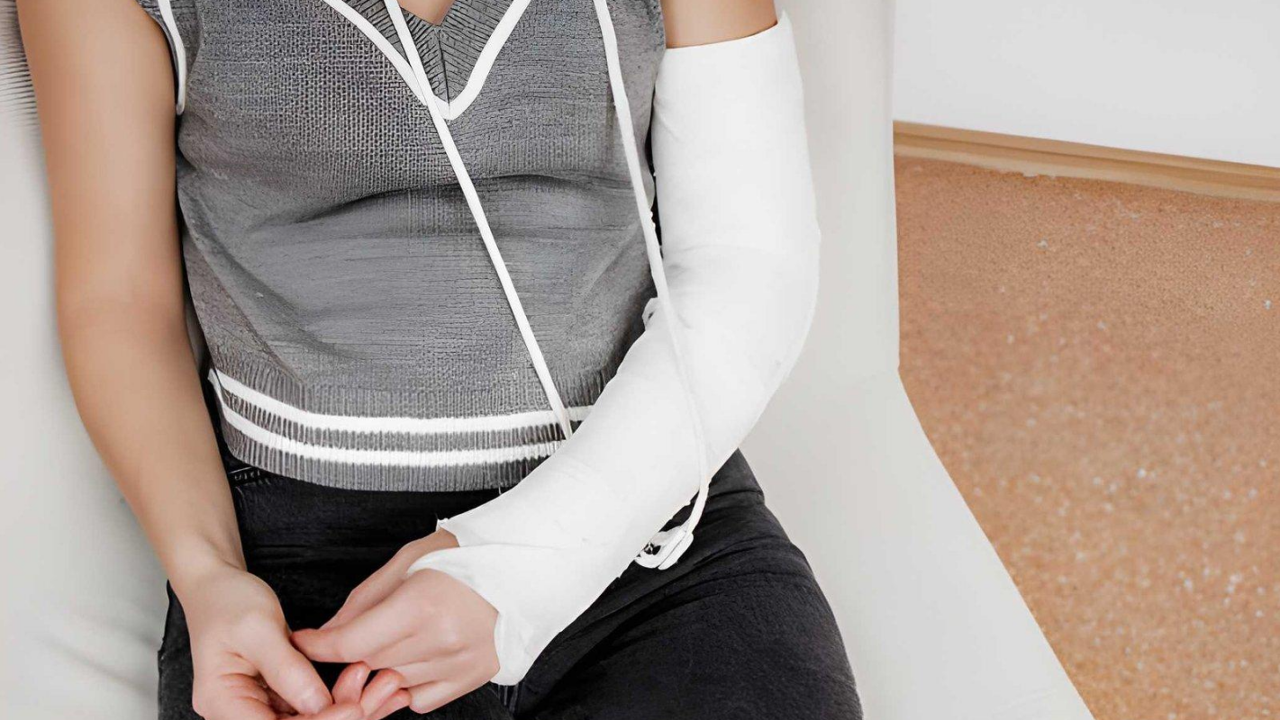 Support My Recovery from a Severe Broken Arm