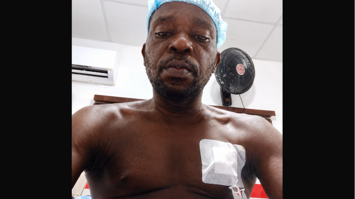 Kidney Transplant