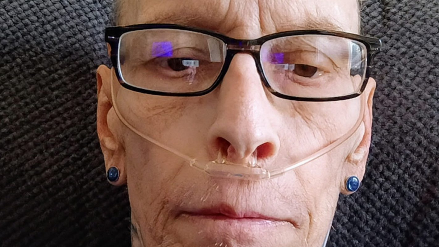 Medical Bills due to Cancer