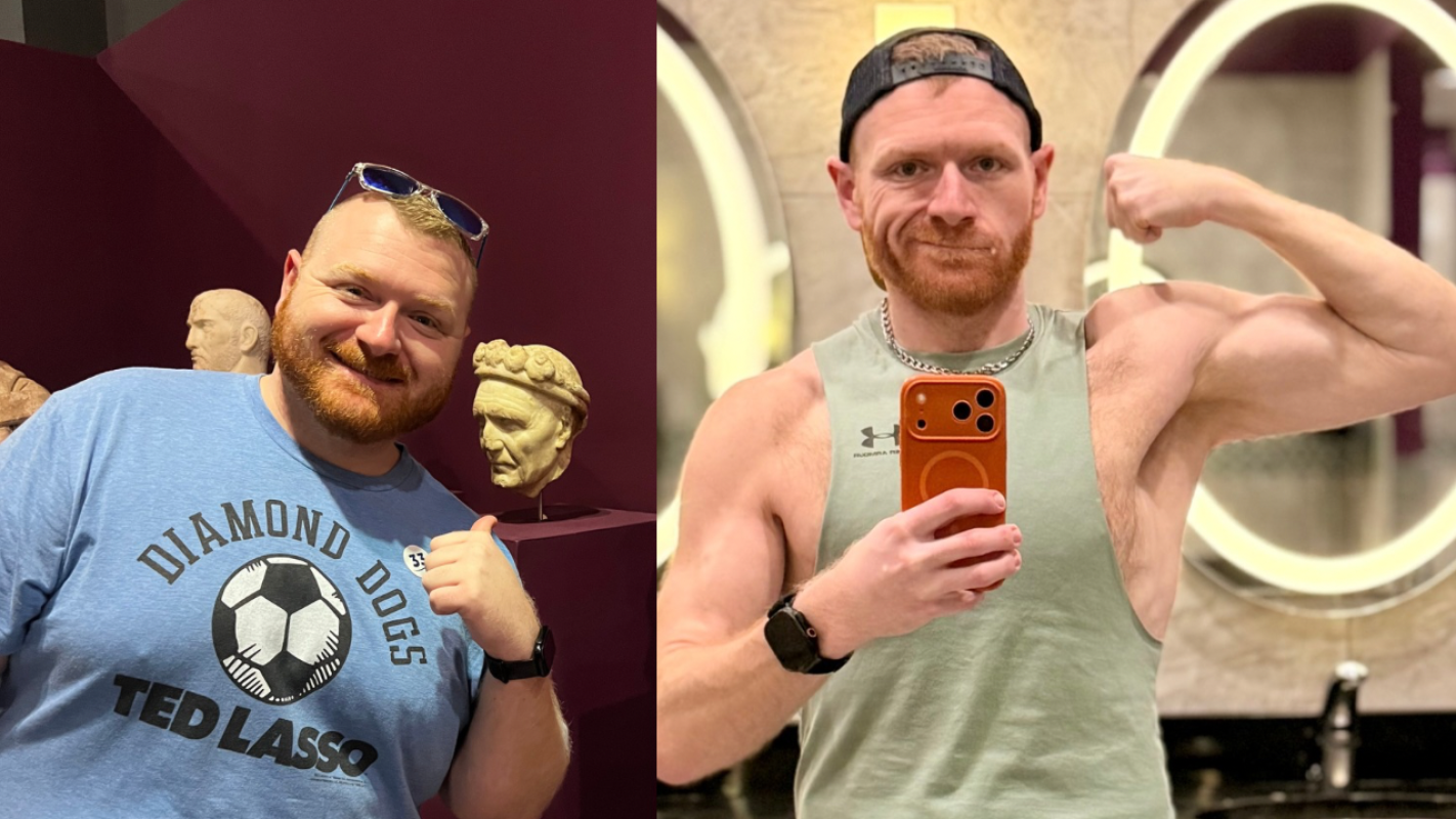 Skin Removal Reconstruction