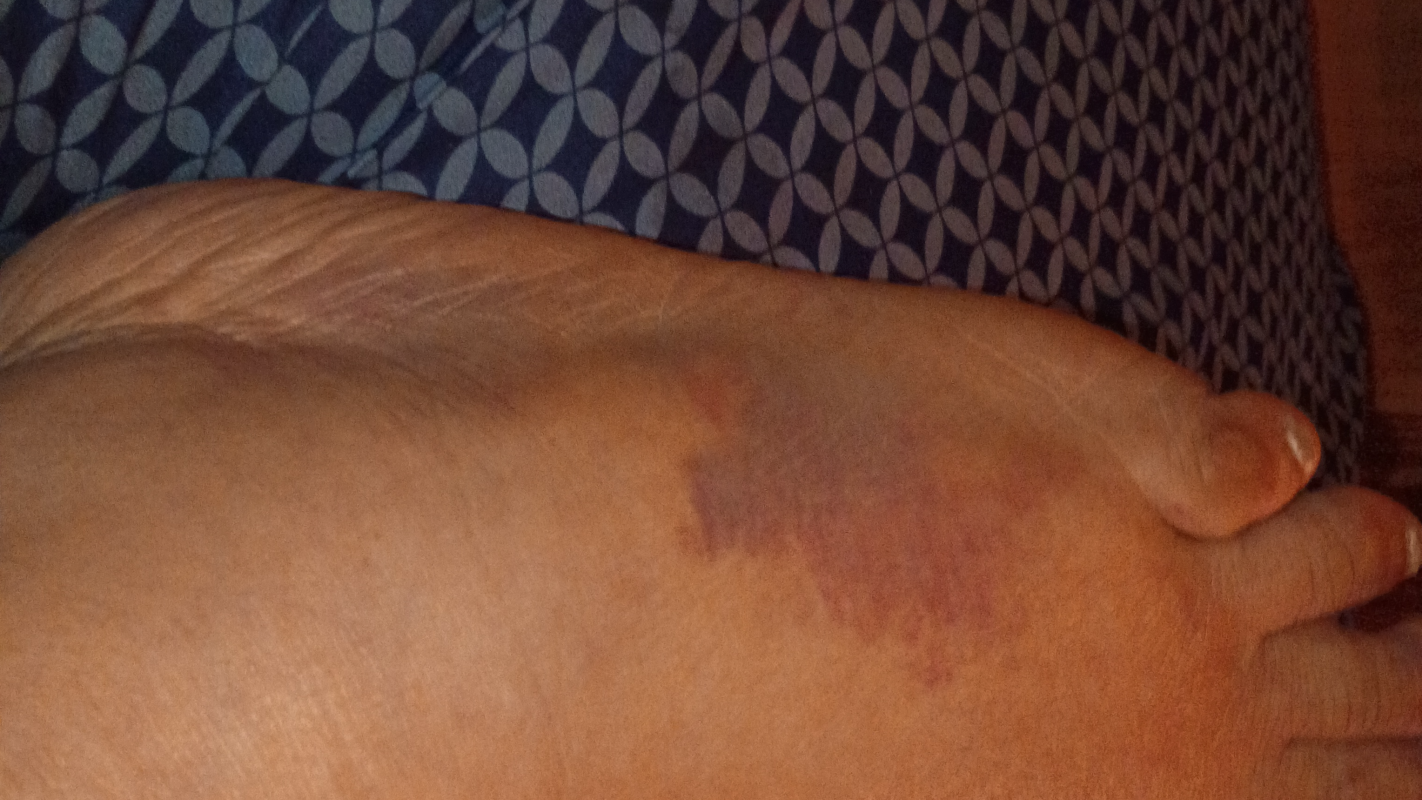 Successful Recovery from life changing accident