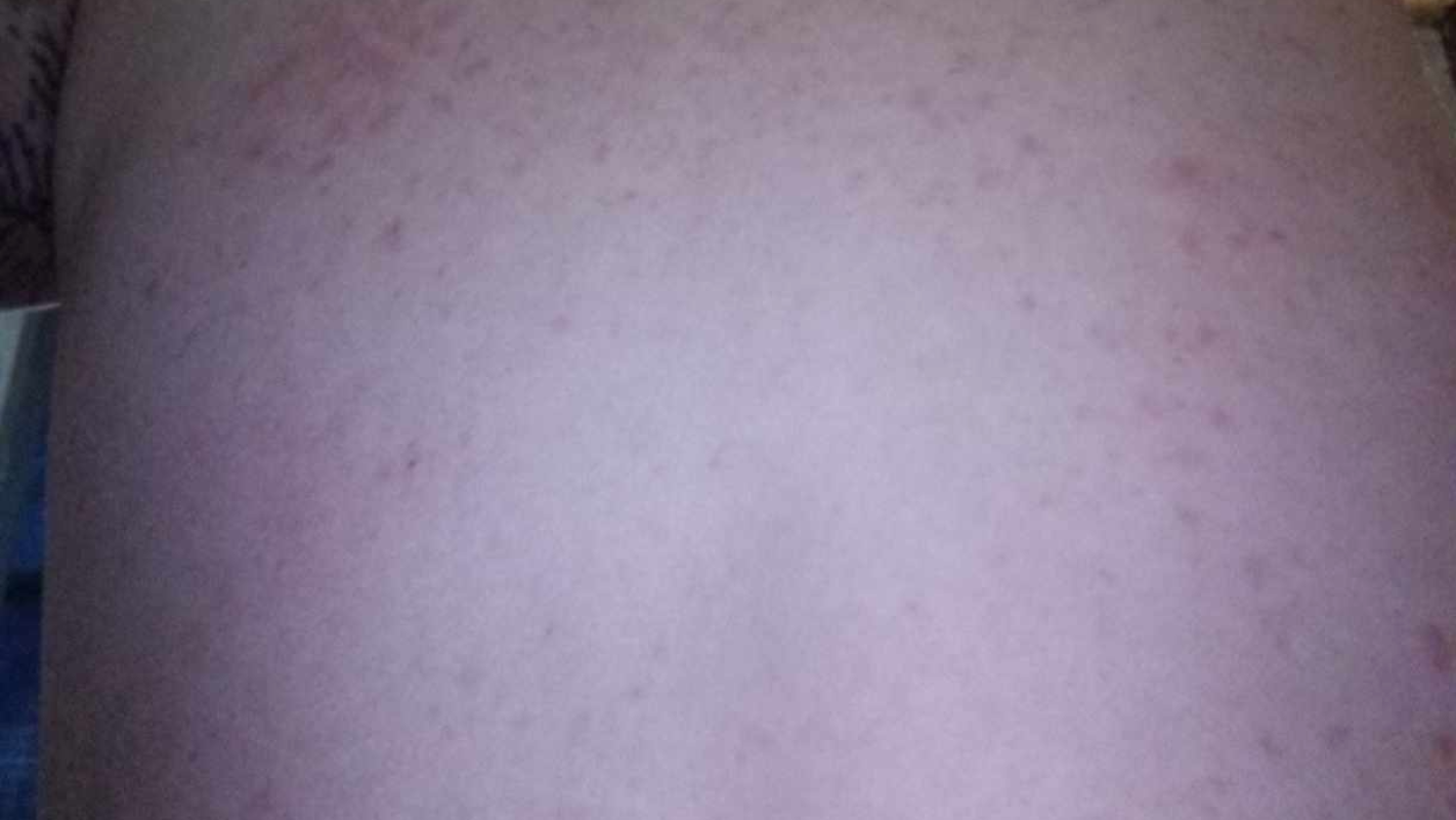 Medical and other expenses