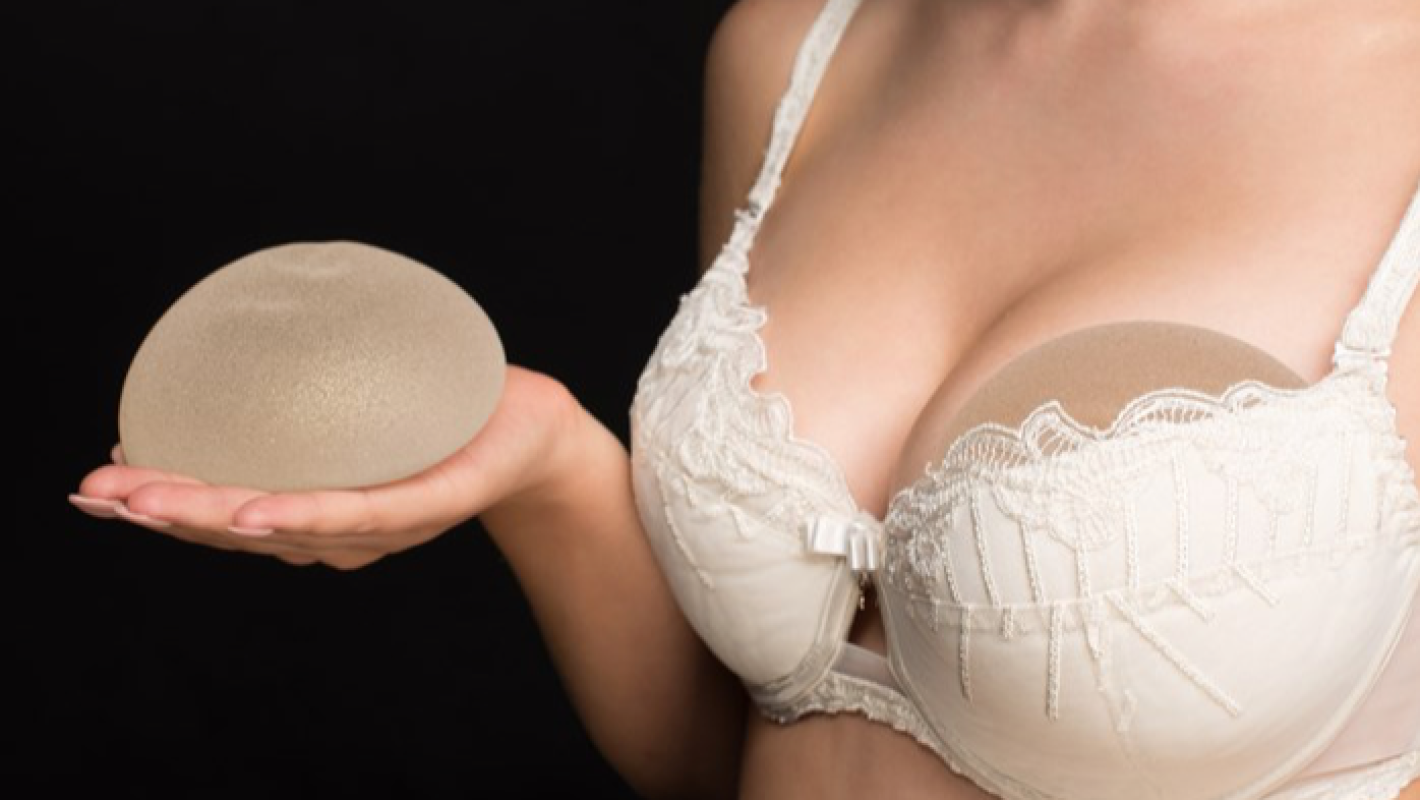 Breast implants