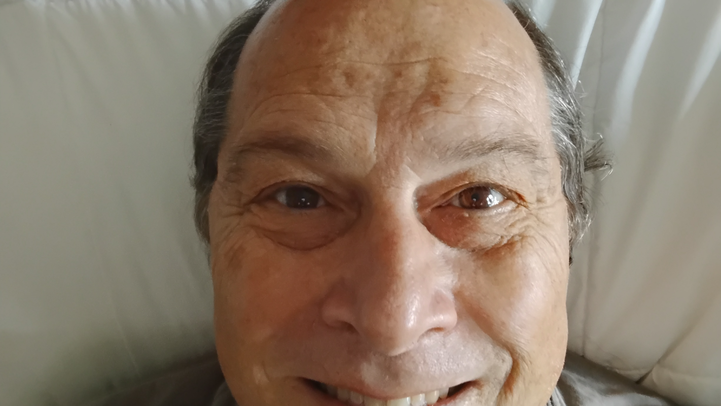 Blindw/brain injury Dave