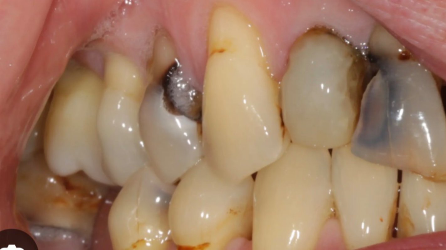 Help with dental