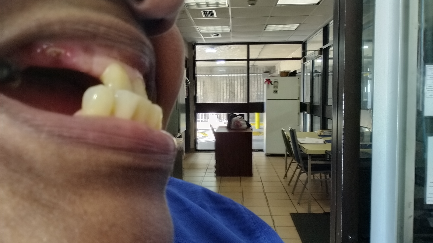 Help with dental surgery