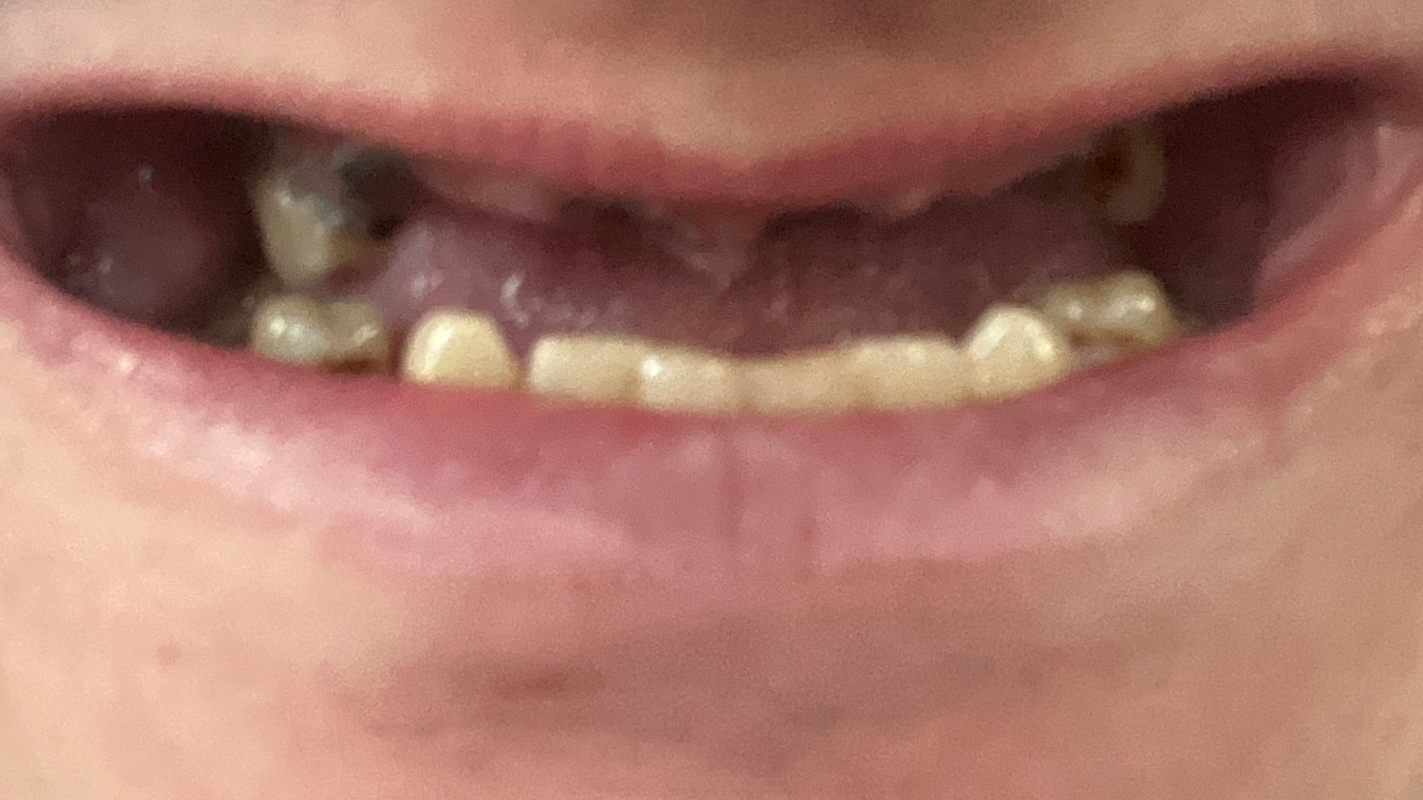 Fix my mouth and health issues