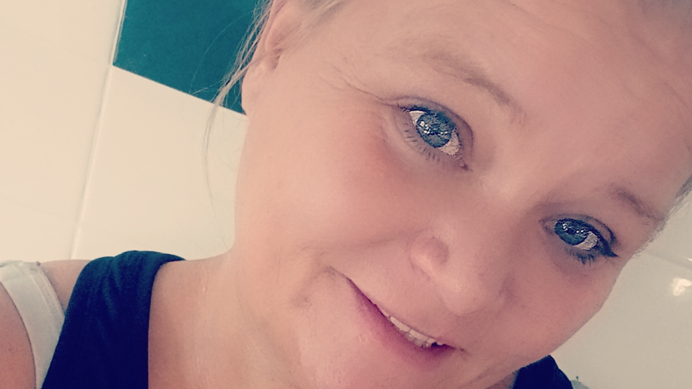 Full knee replacement