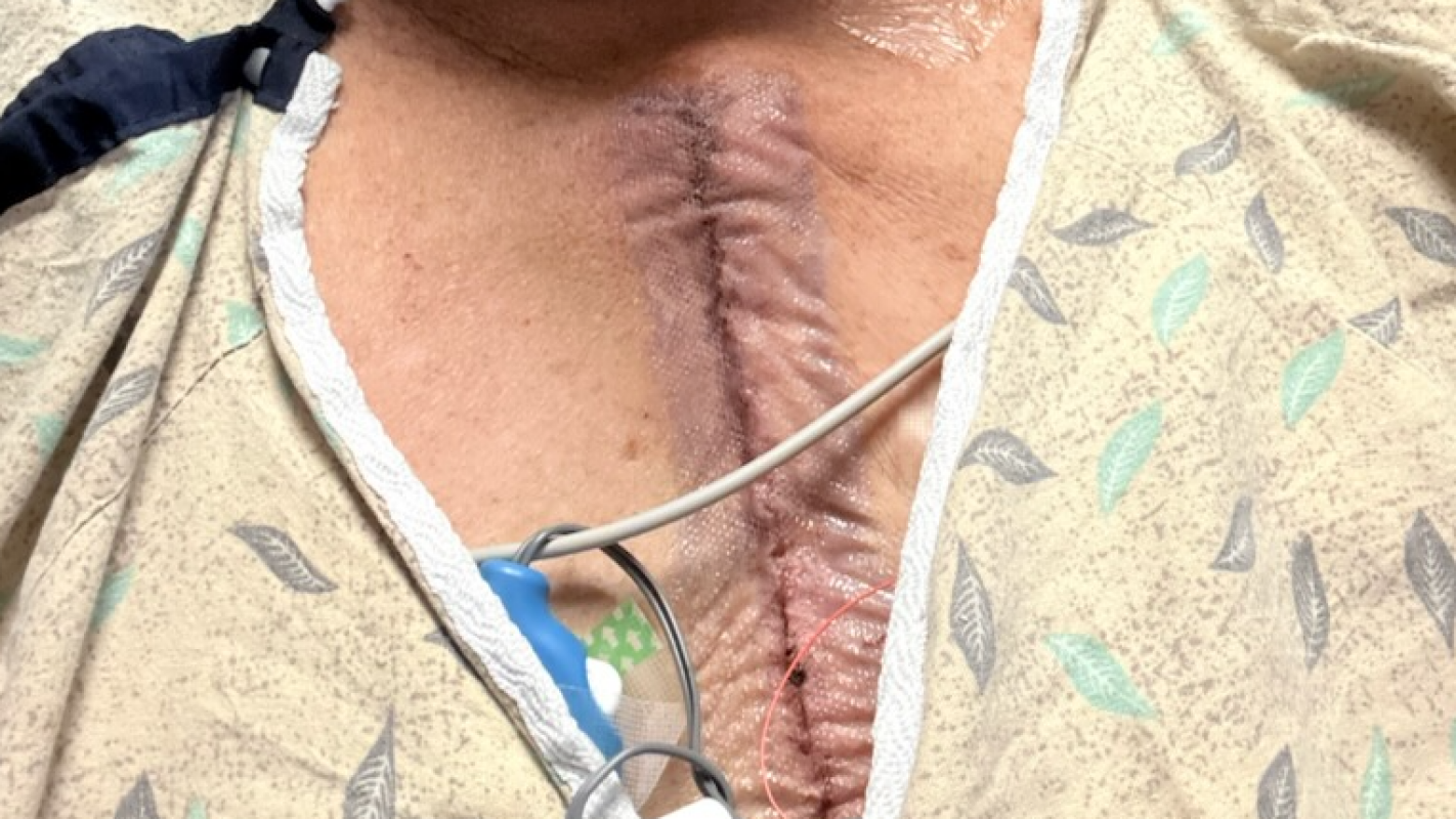 Jimmy's Medical Expenses