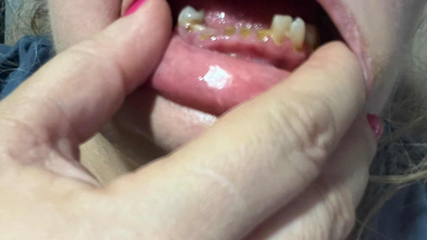 Dental emergency