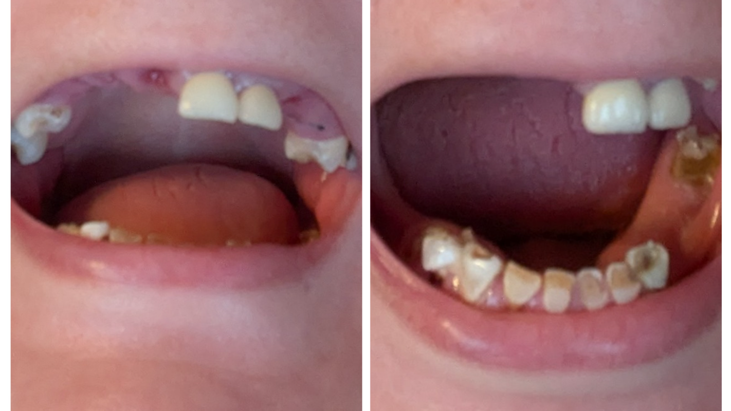 Give me my smile back